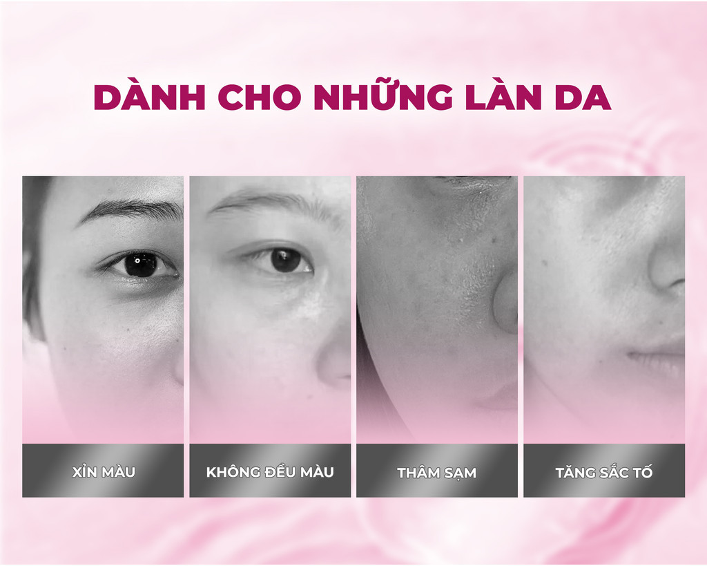 Mô tả Combo 10 Mặt Nạ BNBG Tinh Chất Tăng Cường GLUTATHIONE Hỗ Trợ Làm Sáng Và Dưỡng Trắng Da 30mlx10 - 7