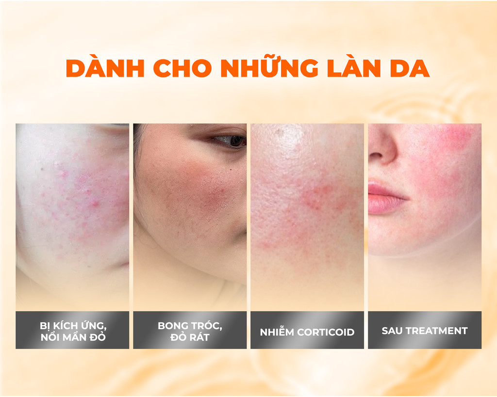 Mô tả Combo 10 Mặt Nạ BNBG Tinh Chất Tăng Cường PLACENTA Hỗ Trợ Làm Dịu Và Phục HồI Da 30mlx10 - 7