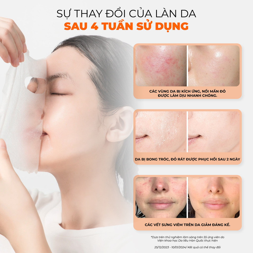 Mô tả Combo 10 Mặt Nạ BNBG Tinh Chất Tăng Cường PLACENTA Hỗ Trợ Làm Dịu Và Phục HồI Da 30mlx10 - 8
