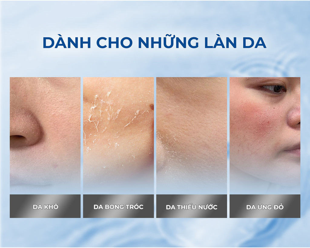 Mô tả Combo 10 Mặt Nạ BNBG Tinh Chất Hỗ Trợ Tăng Cường PDRN Hỗ Trợ Cấp Ẩm Và Căng Bóng Da 30mlx10 - 7