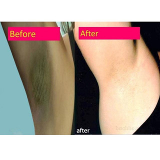 CHE TÊN SP Kem giảm thâm Nách và khử mùi hôi nách 88 Total White Underarm Cream Thái Lan 35gr chính hãng