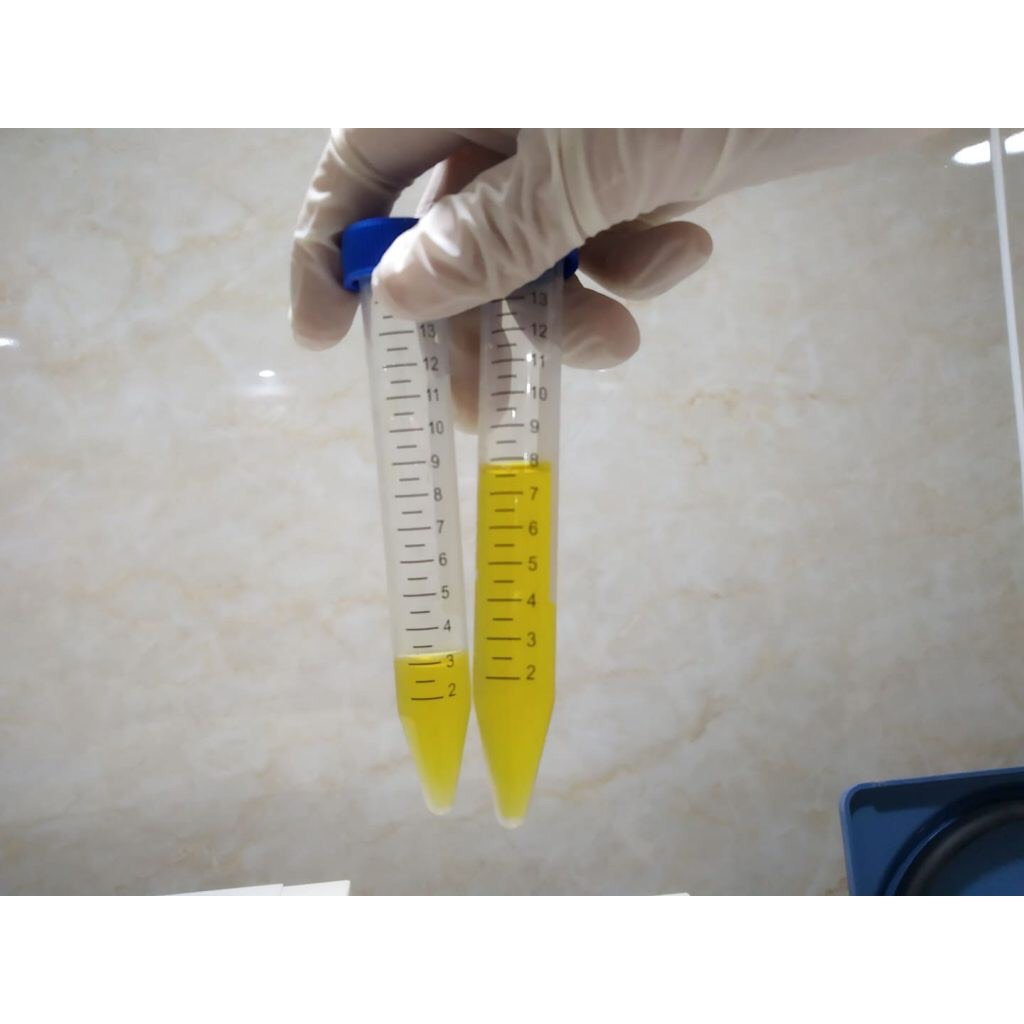 Bộ KIT PRP TỰ HOẠT HOÁ 4.0 - HÀNG CÔNG TY