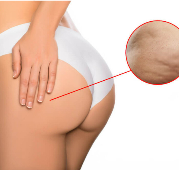 Xà Phòng Tắm Pelican Hip Care Scrub Soap Dạng Hạt Tẩy Tế Bào Chết (80g)