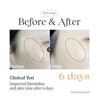 Kem dưỡng trắng PESTLO Rejurecipe TXA Cream 30ml [Date 29/01/2027]
