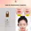 kem FACE hoa mãu đơn + SERUM dưỡng trắng da mờ thâm nám tàn nhang dưỡng da cấp ẩm 93skina