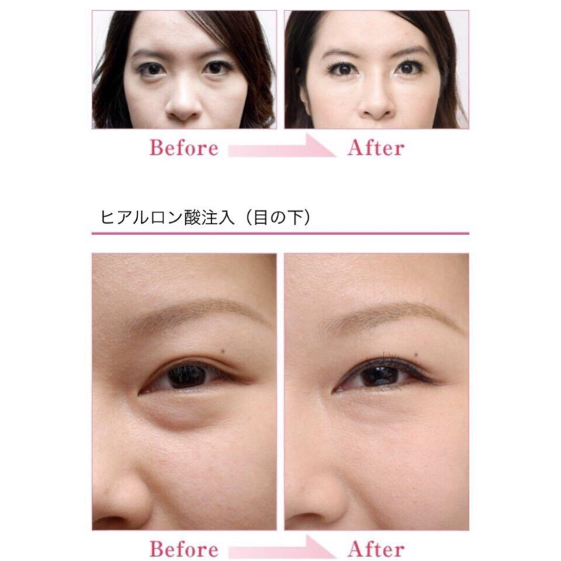 Serum cấp ẩm phục hồi da HA Nhật Bản trẻ hoá làn da Hộp 10 tuýt x 2.5ml - PhuongAnHouse