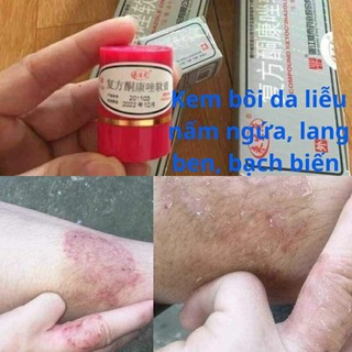 Kem bôi hắc lào, nấm ngứa, á sừng, lang ben, vẩy nến - Hàng sẵn