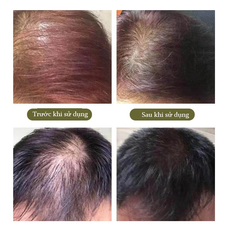 Chất lượng Dầu Gội Hỗ Trợ Nuôi Dưỡng Tóc