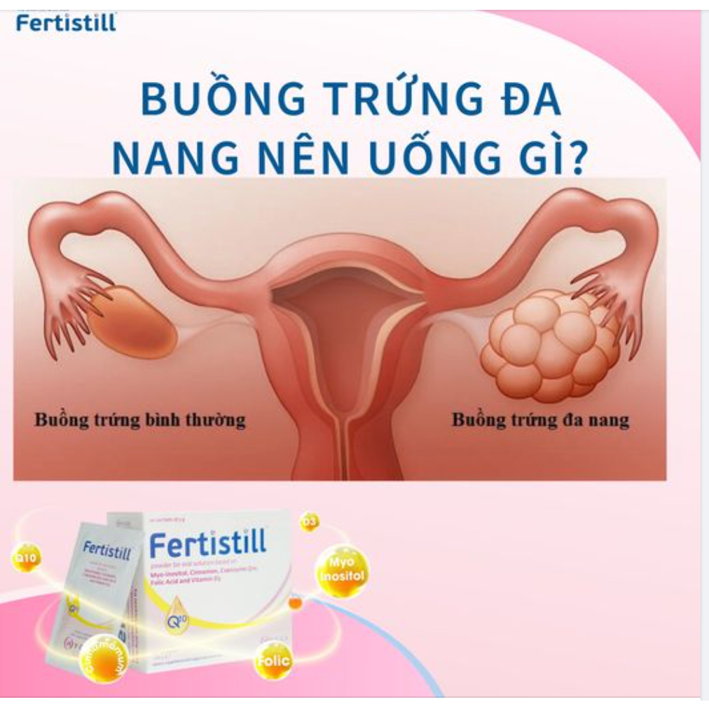 Fertistill - Bổ trứng, Tăng khả năng thụ thai, điều hoà kinh nguyệt, Đa nang buồng trứng hộp 20 gói