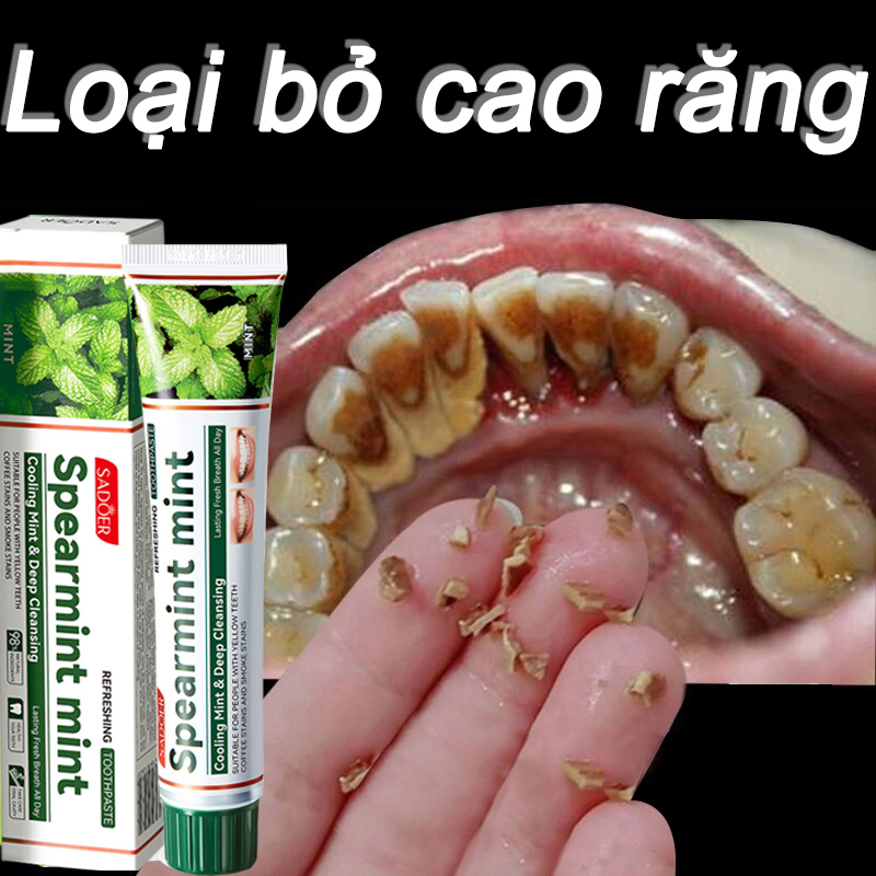 Kem đánh răng tẩy ố vàng: Bí quyết cho nụ cười trắng sáng