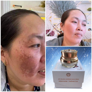 [CHÍNH HÃNG] Kem Nám Saffaron Giúp Tăng Sinh Collagen Mờ Thâm Nám Cho Làn Da Trẻ Trung Sáng Mịn