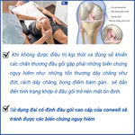 Đai cố định đầu gối cao cấp giúp ổn định giảm đau phòng tránh các biến chứng sau phẫu thuật hoặc sau chấn thương 5760 — ảnh 3