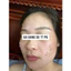 Metosi pg skin - tái sinh đa tầng
