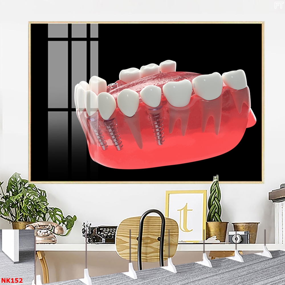 Tranh Treo Tường Tráng Gương Chủ Đề Răng Miệng Phù Hợp Trang Trí Nha Khoa OHA Decor