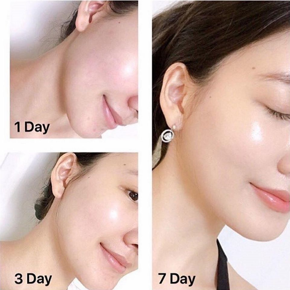 Ảnh Kem Dưỡng Ban Đêm Olay Total Effects 7 In 1 dưỡng da, tái tạo và làm đẹp da một cách tối ưu, chống lão hóa 1