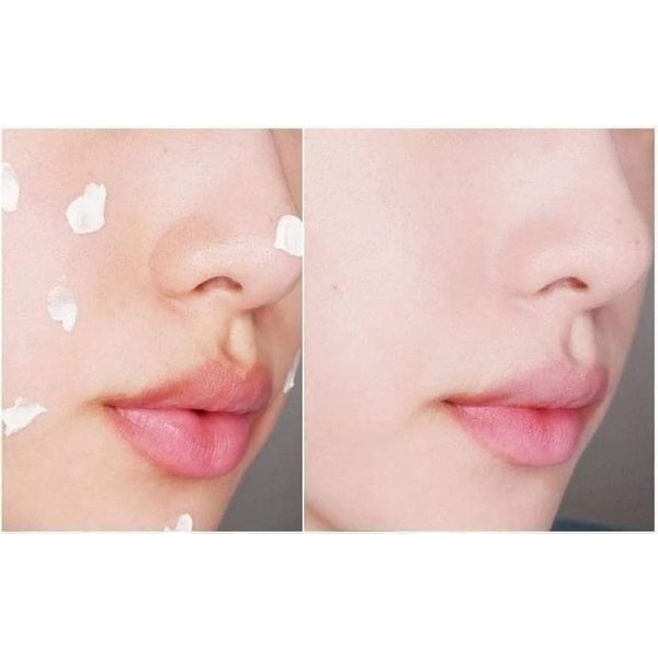 KEM DƯỠNG DA HÀN QUỐC FORENCOS - 50ML