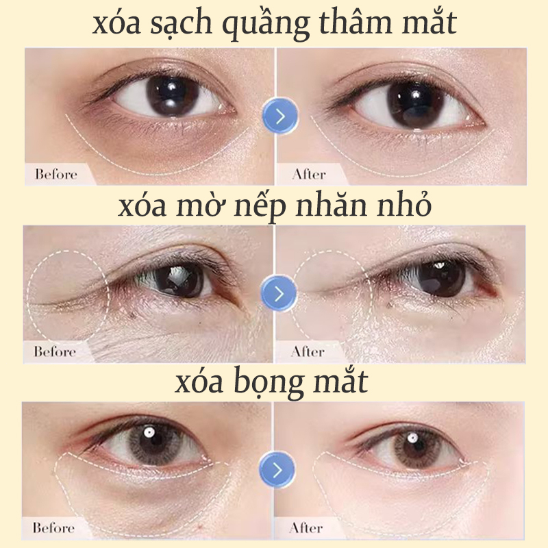 Chất lượng Kem Bôi Cao Cấp
