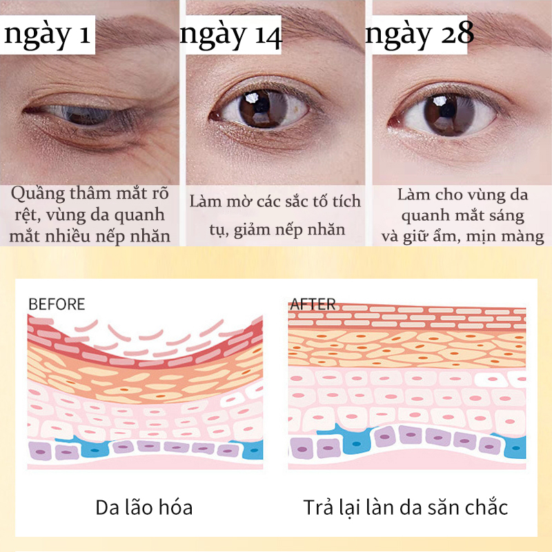 Thiết kế của Tuýp Kem Bôi