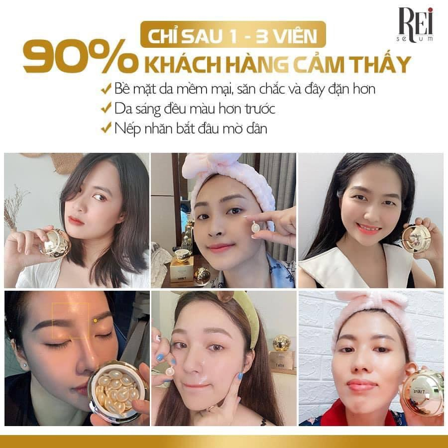 Tinh chất Tế bào gốc mô mỡ REI Serum T’s Kiss Nhật Bản dưỡng trắng, căng bóng và phục hồi da chuyên sâu Hộp 30 viên