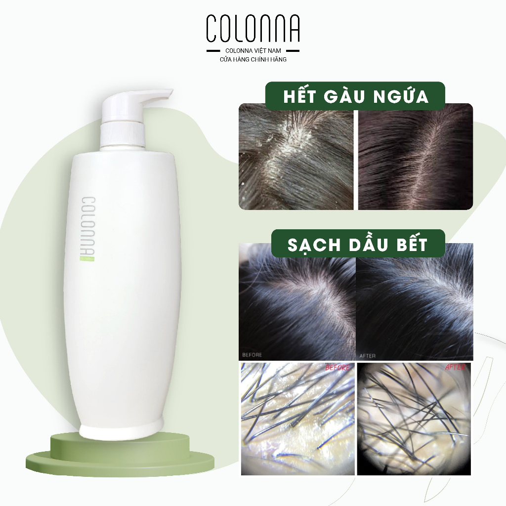 Dầu gội chăm sóc chuyên nghiệp COLONNA giảm gàu, nấm ngứa da đầu