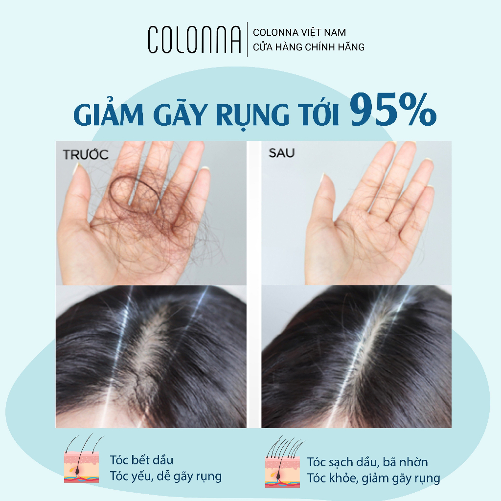 Dầu gội ngăn gãy rụng tóc