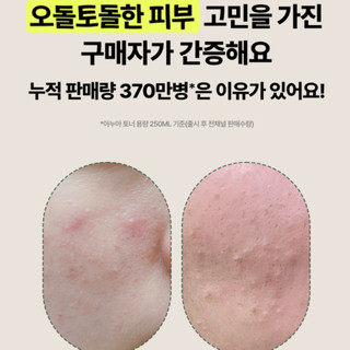 Toner diếp cá giảm mụn ANUA 77 Heartleaf Soothing