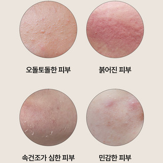 Toner diếp cá giảm mụn ANUA 77 Heartleaf Soothing