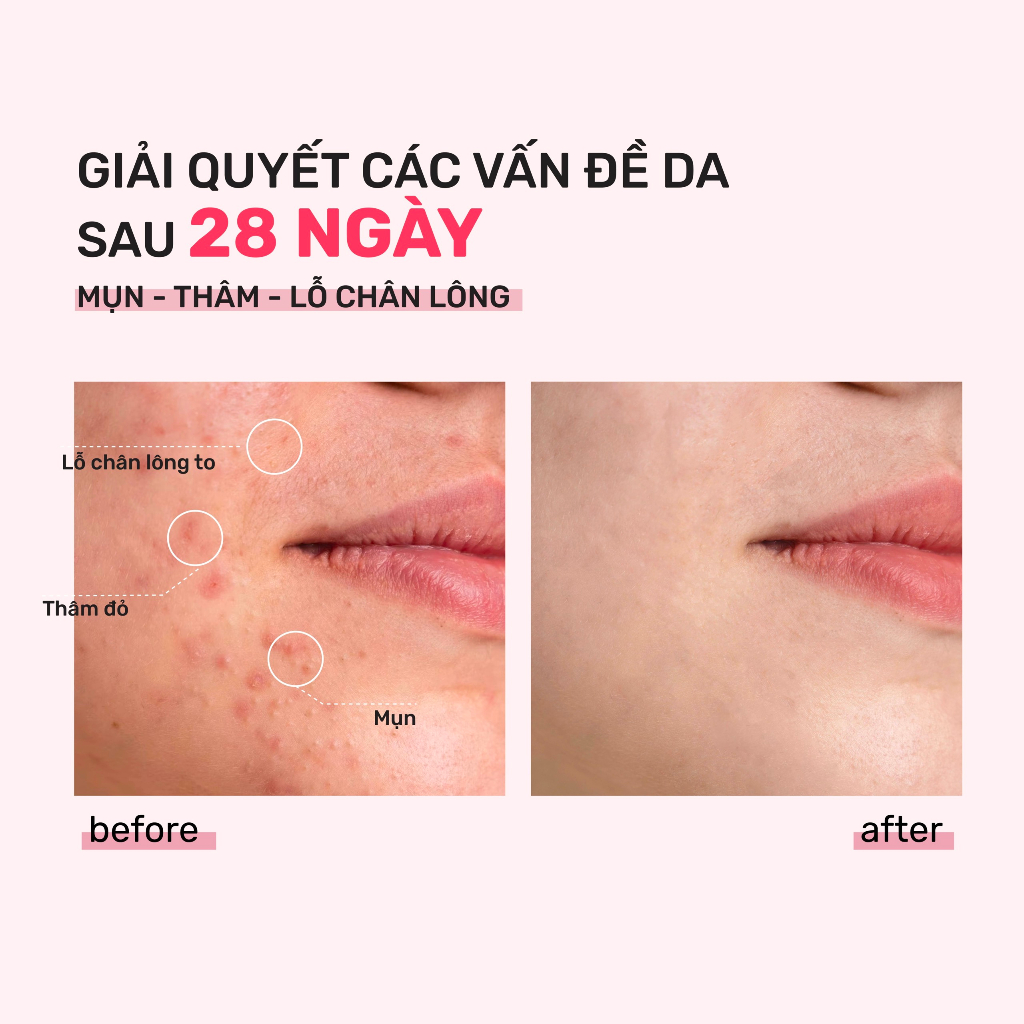 Ảnh Bộ Đôi Toner Derladie 500ml, Serum Derladie Laboratoire Pore Tightening Ampoule Niacinamide 20% + Zic PCA 1% 30 2