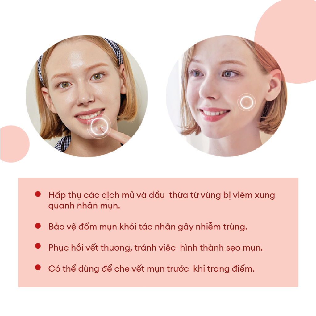 Ảnh Combo Sạch Da  Acne Pimple Master Patch 24 Miếng + Sữa Rửa Mặt Low Ph Good Morning 50ml 4