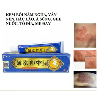 Kem bôi vẩy nến hắc lào nấm nước ăn tay, tổ đỉa, viêm da cơ địa, ghẻ nước - Hàng chính hãng