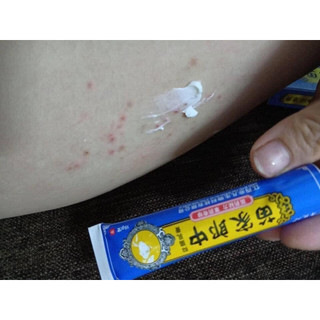 Kem bôi vẩy nến hắc lào nấm nước ăn tay, tổ đỉa, viêm da cơ địa, ghẻ nước - Hàng chính hãng