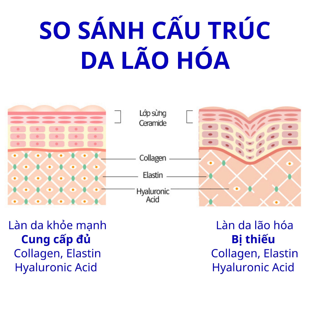 Ảnh Bột uống BB LAB The Elastin Tăng Độ Đàn Hồi, Giảm Chảy Xệ, Nhăn Nheo,Rạn Da,Nếp Nhăn Khỏe Miệng,Mắt,Trán 2g x 30 Gói 3