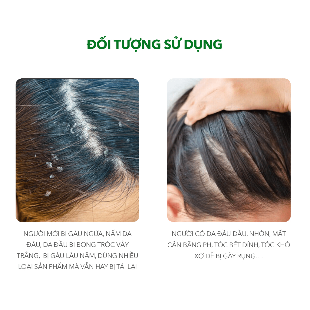 Ảnh Combo 3 Chai Dầu Gội Sạch Gàu Antisol | Thương Hiệu iCare Pharma | Làm Sạch Gàu Nấm Ngứa Da Đầu 3