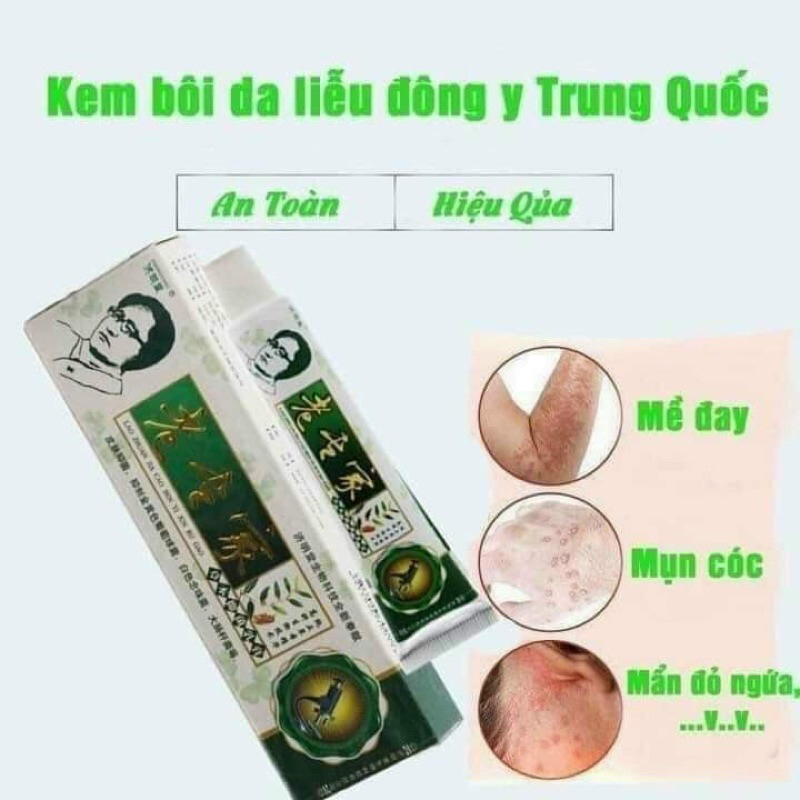 Kem bôi ngoài da chống nứt nẻ khô da Á sừng