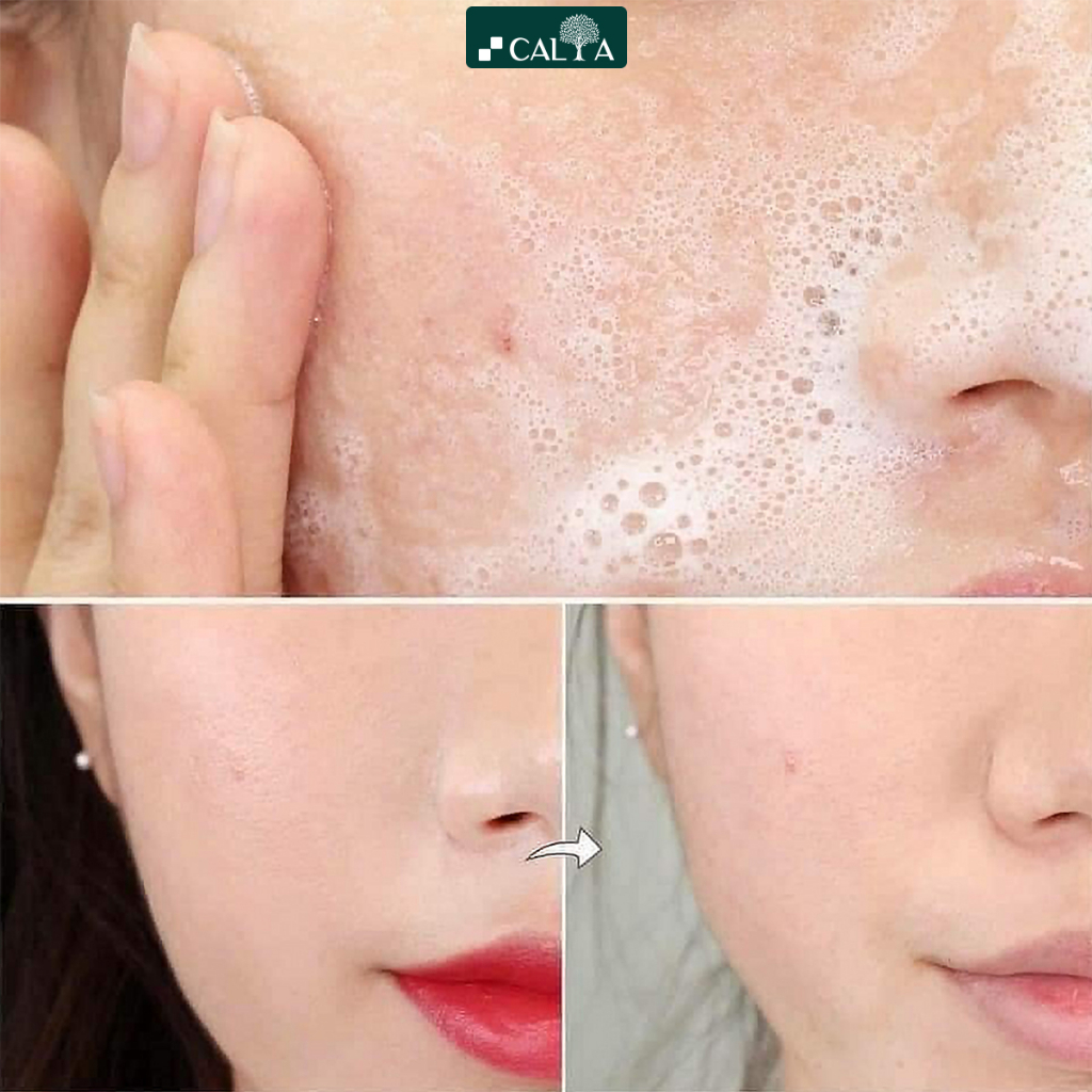 Ảnh Sữa Rửa Mặt La Roche Posay Cho Da Dầu Mụn, Nhạy Cảm - Effaclar Purifying Foaming Gel 50ml 4