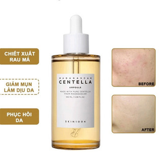 Serum Rau Má Skin1004 Madagascar Centella Asiatica Ampoule 30ml - 55ml - 100ml giảm mụn, phục hồi da