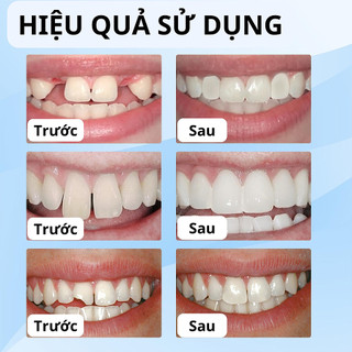 Dung dịch táI tạo răng dung dịch nha khoa cảI thiện răng mẻ sứt gãy
