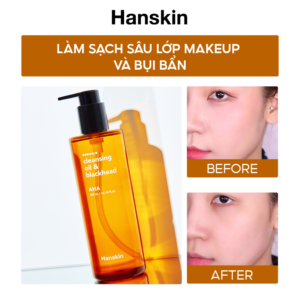 [Review] Dầu tẩy trang HANSKIN Cleansing Oil & Blackhead AHA 300ml có tốt không?