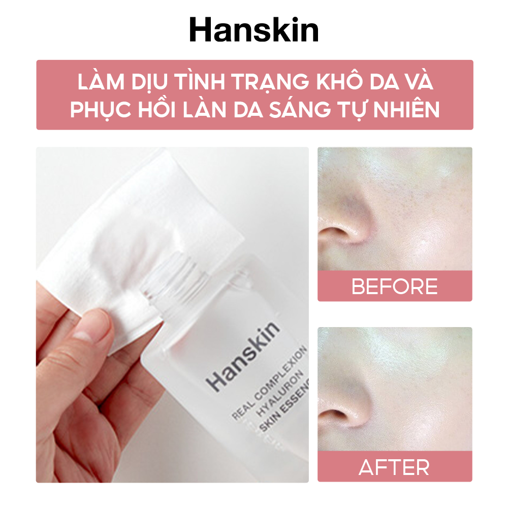 TINH CHẤT DƯỠNG ẨM CHỐNG LÃO HÓA HANSKIN