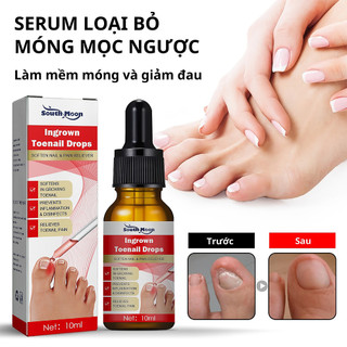 Serum phục hồI móng chân bị mọc ngược làm sáng sạch khử mùI khử khuẩn