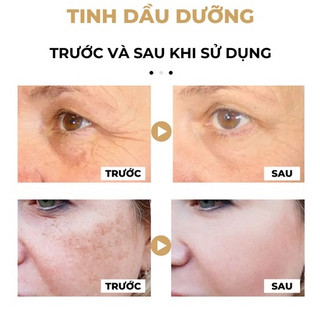 Tinh dầu dưỡng trắng da chống lão hóa loạI bỏ nếp nhăn tàn nhàng đốm đen da mặt