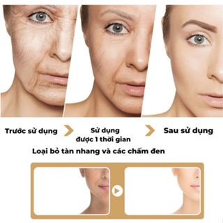 Tinh dầu dưỡng trắng da chống lão hóa loạI bỏ nếp nhăn tàn nhàng đốm đen da mặt