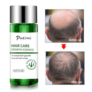Tinh dầu mọc tóc serum mọc tóc kích thích mọc tóc giành cho ngườI hói rụng tóc