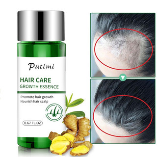 Tinh dầu mọc tóc serum mọc tóc kích thích mọc tóc giành cho ngườI hói rụng tóc