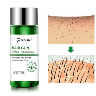 Tinh dầu mọc tóc serum mọc tóc kích thích mọc tóc giành cho ngườI hói rụng tóc