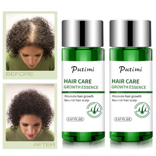 Tinh dầu mọc tóc serum mọc tóc kích thích mọc tóc giành cho ngườI hói rụng tóc