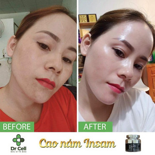 Cao nám INSAM Dr Cell- ngăn ngừa nám, lão hóa da , làm mờ vết thâm do mụn 20g