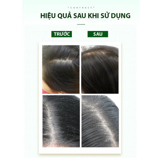 Dầu gộI bạc hà polygonum mul tiflorum sampoo 300ml dầu gộI sạch gầu giảm rụng tóc