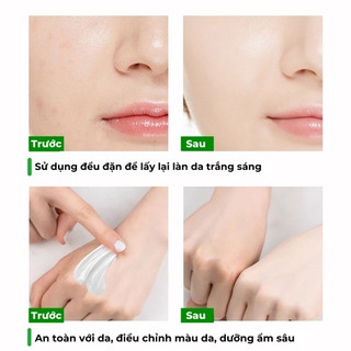 Kem dưỡng ẩm tắng da hết thâm cách da kem dưỡng da tẩy tế bào chết phục hồI da trắng sáng mịn màng 35ml