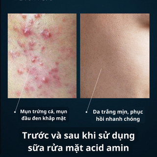 Sữa rửa mặt Images acid amin sạch sâu loạI bỏ mụn dầu thừa nhanh chóng